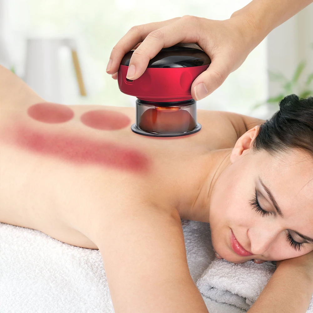 Deep tissue cupping